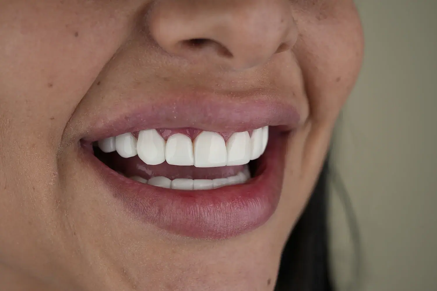 Bright, Healthy Smile — Smile Dental Center