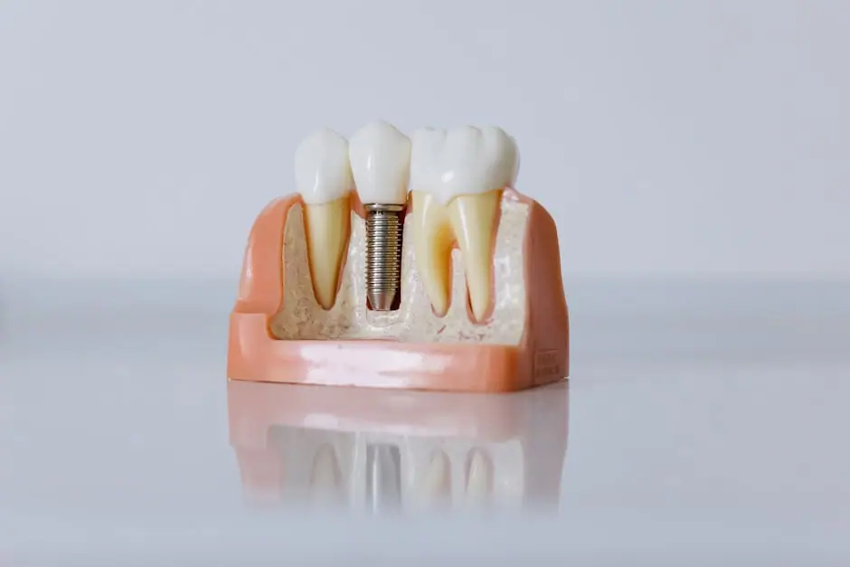 Full-arch dental implant treatment · Smile Dental Center Miami 6