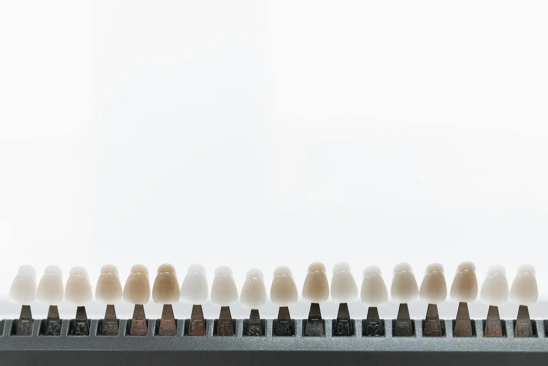 Close-up view of dental veneers on a display rack, showcasing various shades.