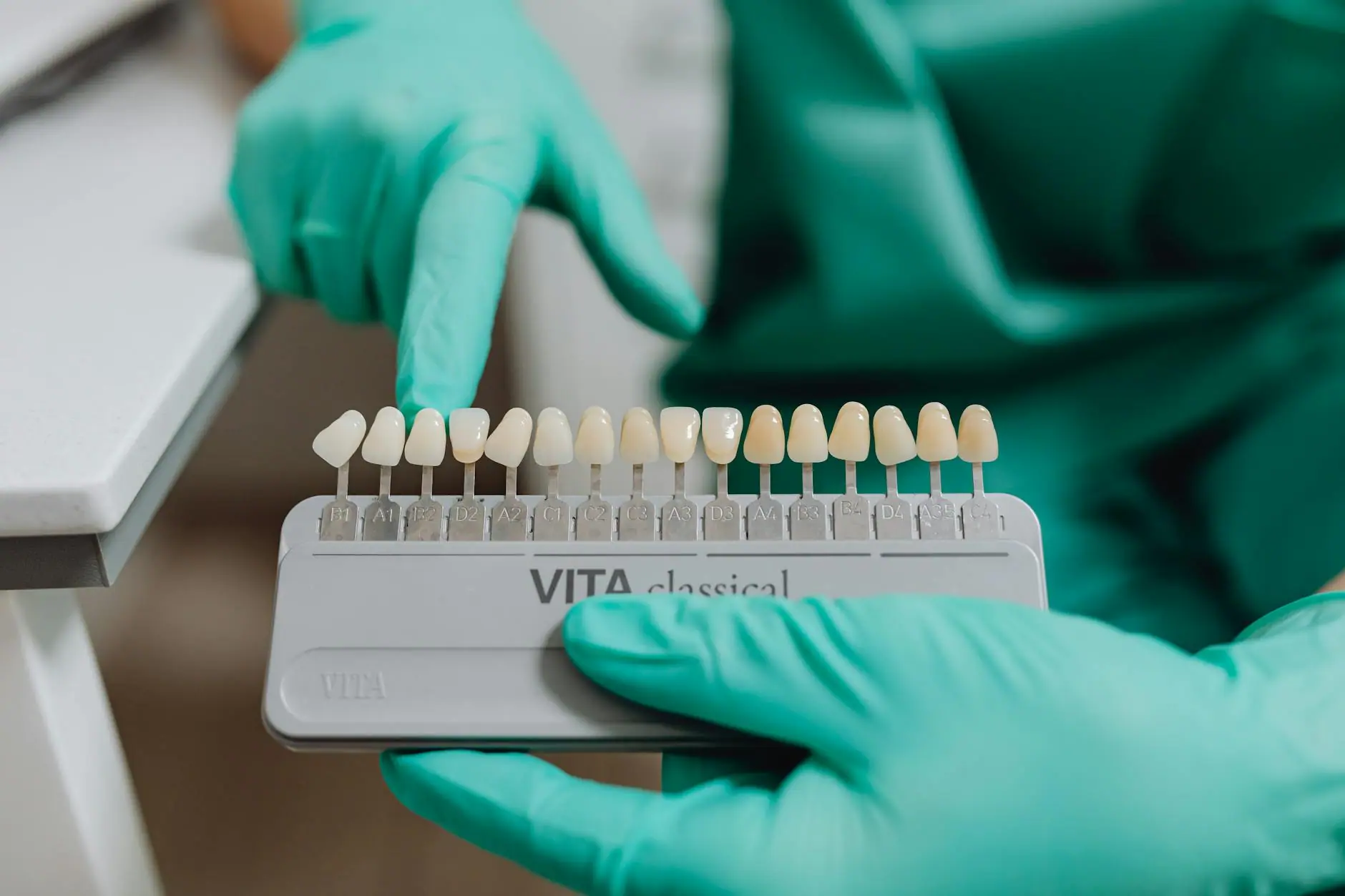 Blanqueamiento Dental : La Ciencia Detrás de una Sonrisa Brillante