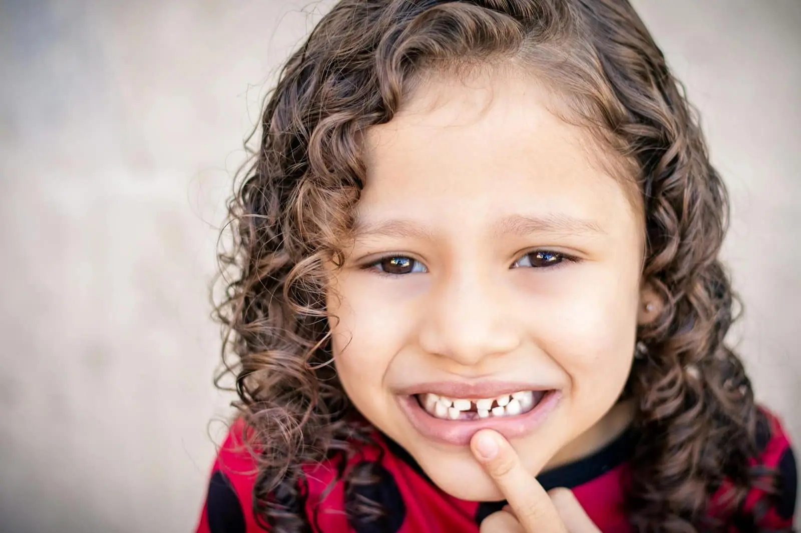 How to Fix Gap Teeth: Veneers, Bonding & Other Options