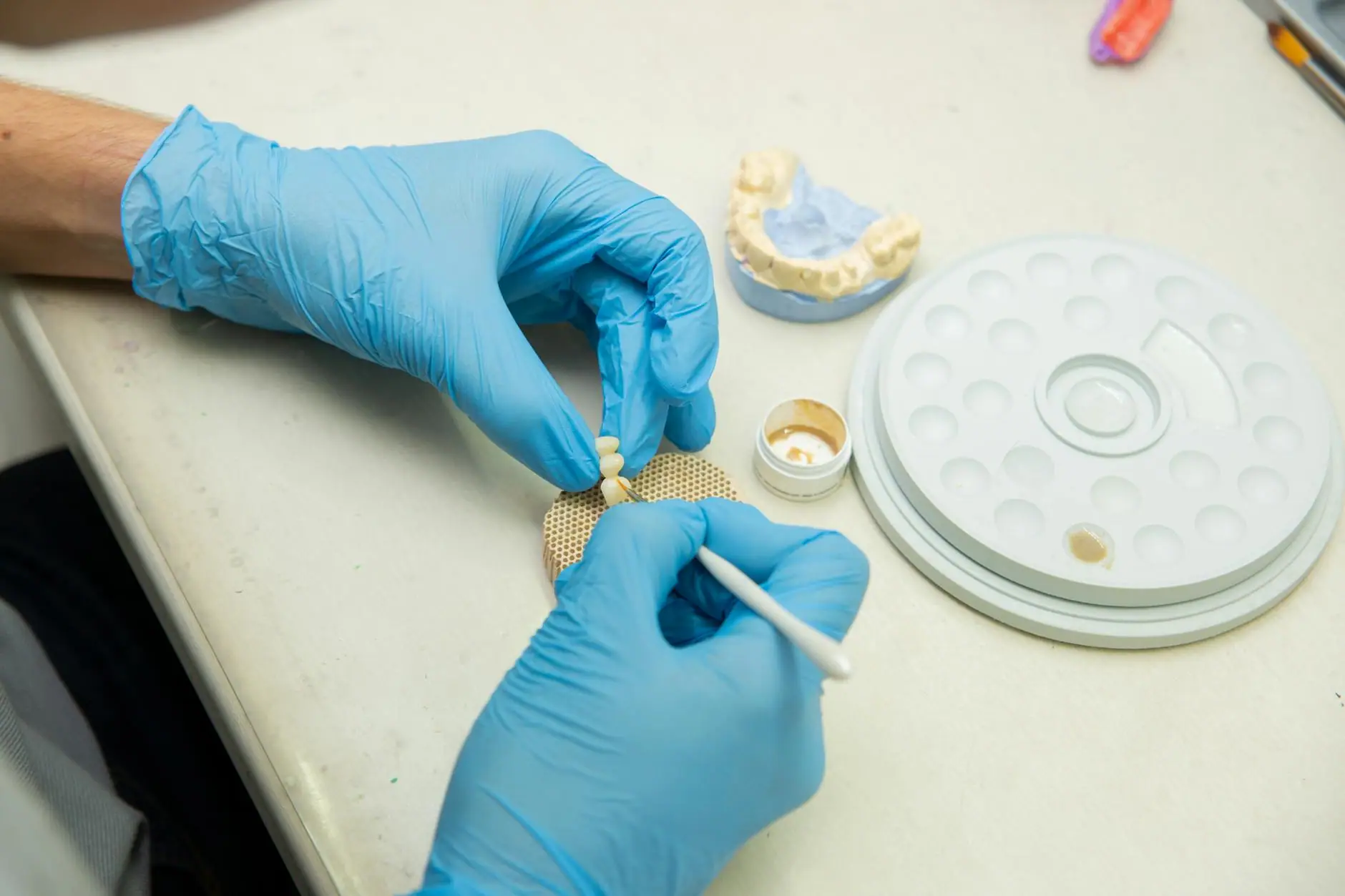 Implantes Dentales en Medellín: Solución Definitiva para Recuperar tu Sonrisa