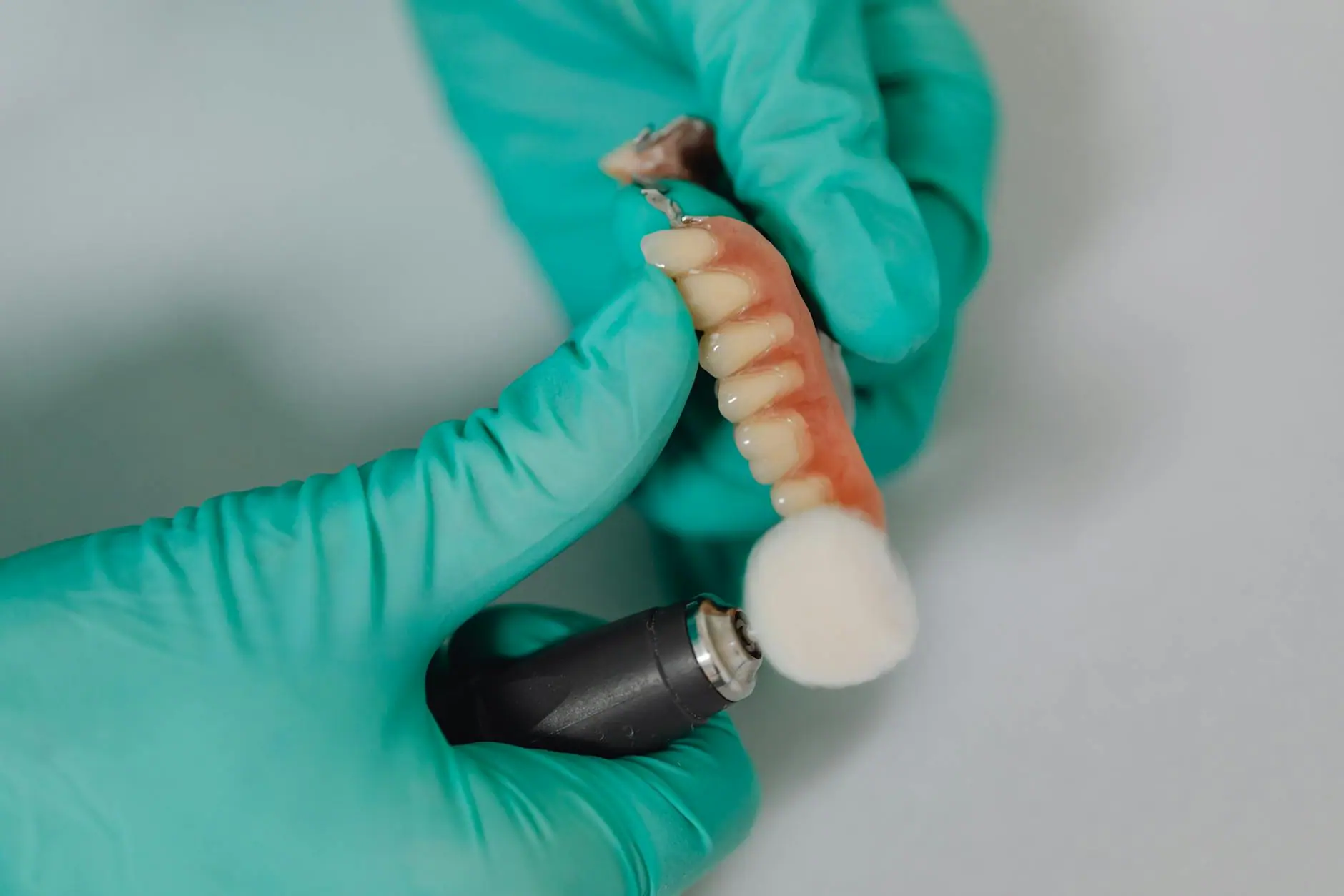 Dental implant treatment · Smile Dental Center Miami 6