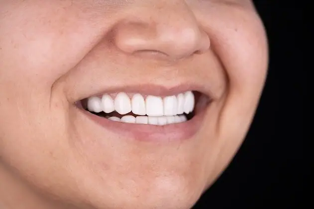 Smile Dental Center clinic in Miami, FL