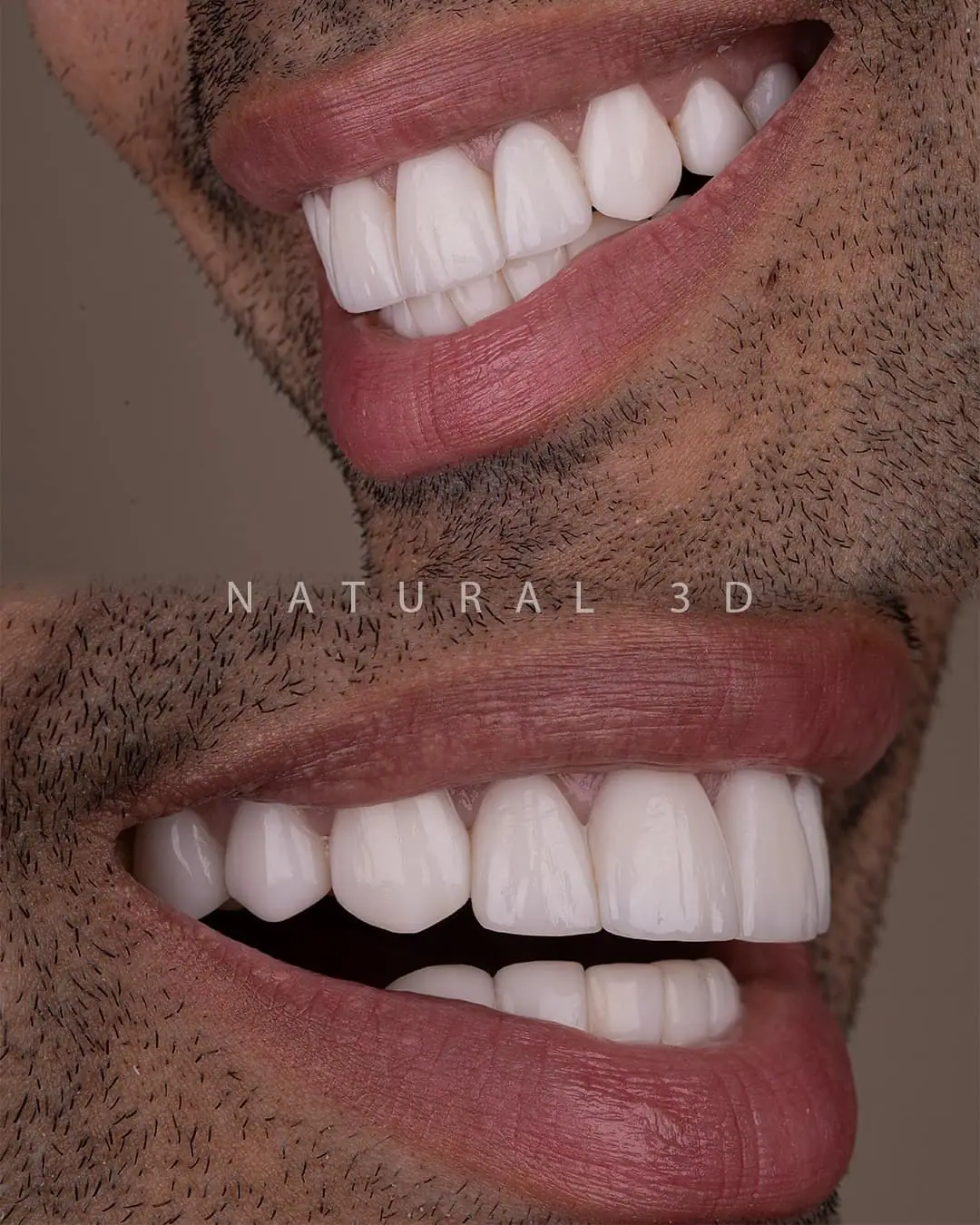 Patient smile after treatment — Smile Dental Center