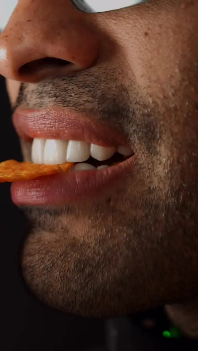 Cosmetic dental result — Smile Dental Center Medellín