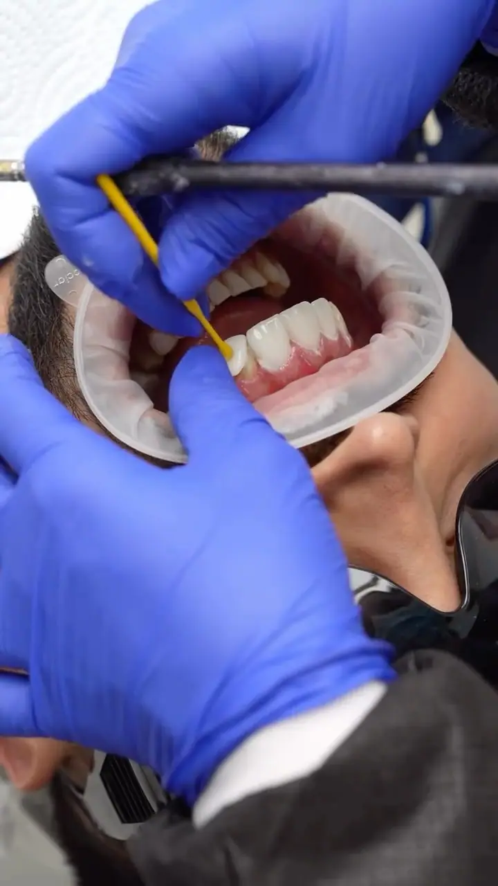 Aesthetic dentistry result — Smile Dental Center