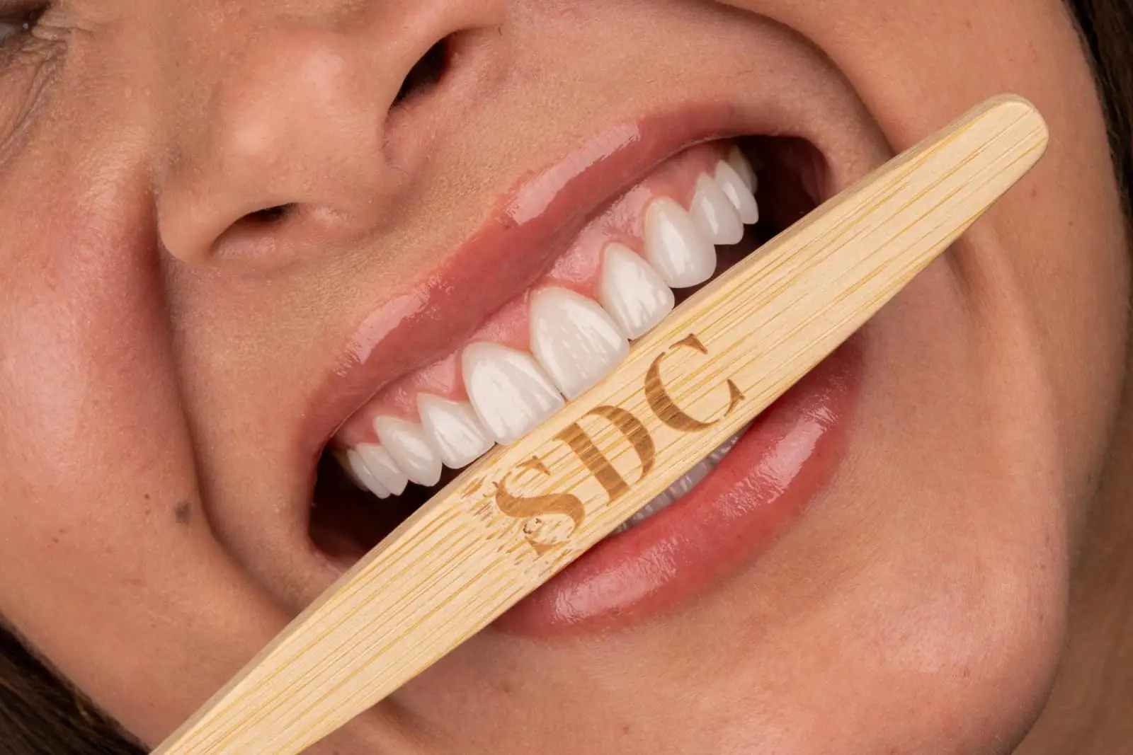 Digital Smile Design session — Smile Dental Center